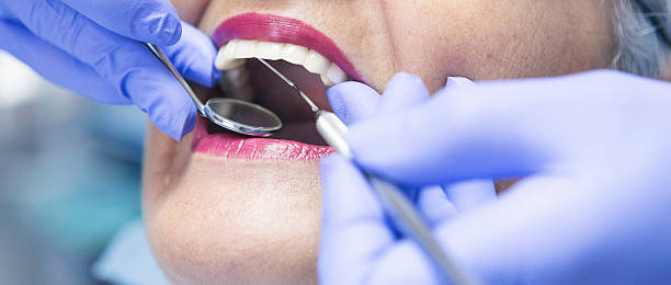 Best Emergency Dental Care for Abscessed Tooth in Ben Bolt, TX
